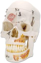 Skeleton Demo Skull