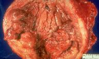 Systemic Pathology