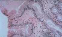 Systemic Pathology