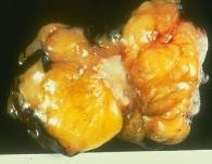 Systemic Pathology